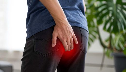 3人に1人がなる“痔”の対策