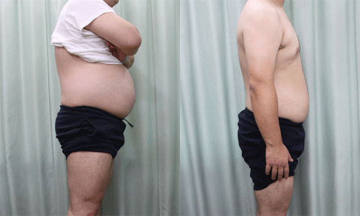 中年男のダイエット